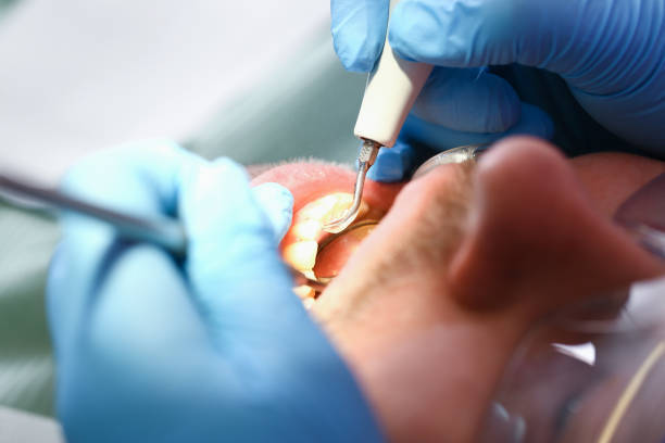 Best Urgent Tooth Repair  in Lawrenceville, NJ