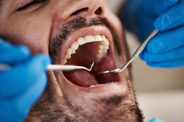 Best Chipped Tooth Repair Near Me  in Lawrenceville, NJ
