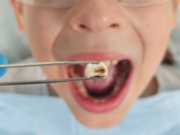 Best Dentist for Tooth Abscess  in Lawrenceville, NJ